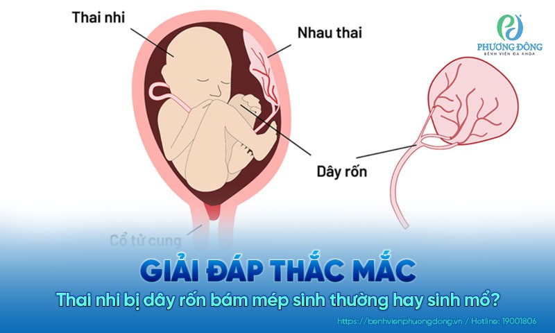 4. Các Biến Chứng Có Thể Xảy Ra