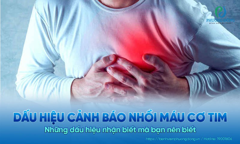 Các dấu hiệu cảnh báo nhồi máu cơ tim mà bạn nên biết