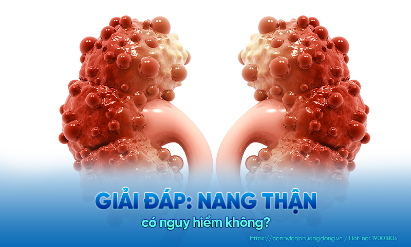 Giải đáp: Nang thận có nguy hiểm không?