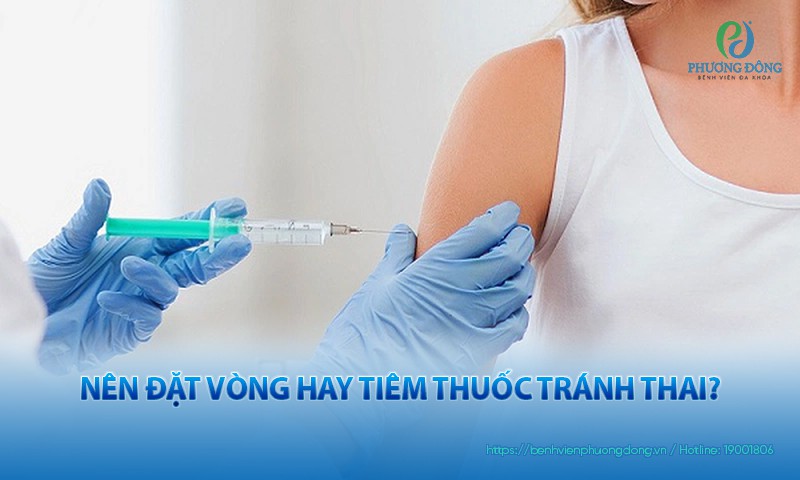 Nên Đặt Vòng Hay Tiêm Thuốc Tránh Thai: Lựa Chọn Phù Hợp Cho Bạn