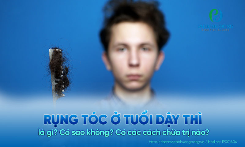 Rụng tóc ở tuổi dậy thì là gì? Có sao không? Có các cách chữa trị nào?