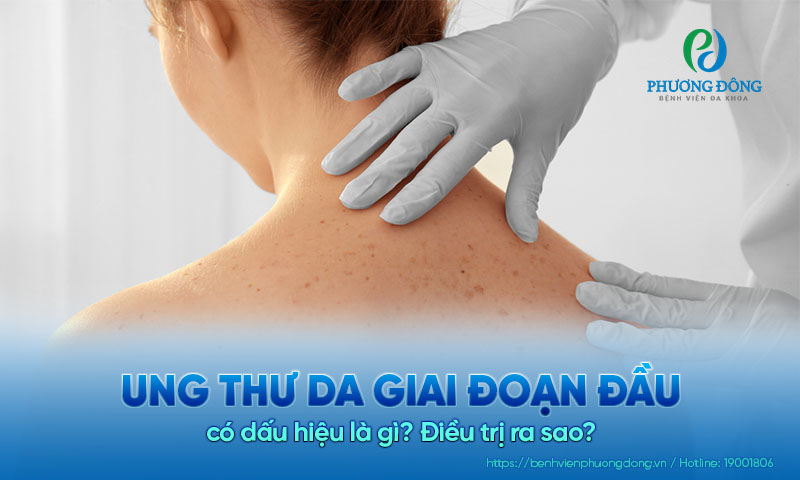 Ung thư da giai đoạn đầu có dấu hiệu là gì? Điều trị ra sao?