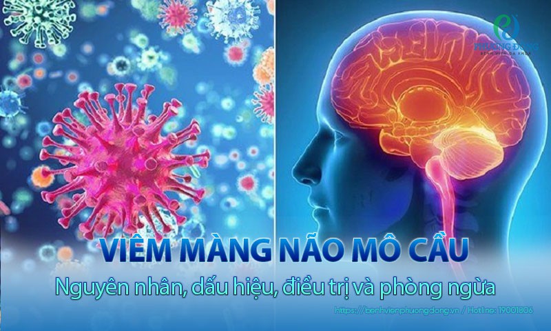 Viêm màng não mô cầu: Nguyên nhân, dấu hiệu, điều trị và phòng ngừa