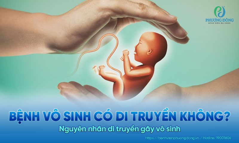 Bệnh vô sinh có di truyền không? Nguyên nhân di truyền gây vô sinh