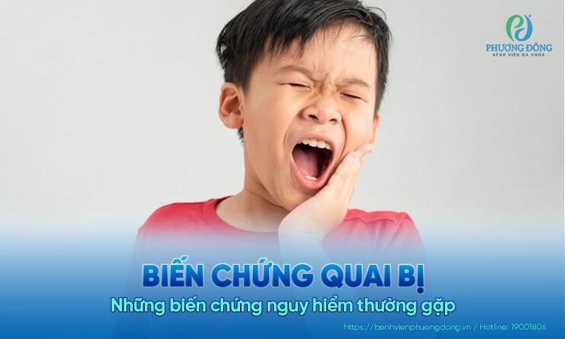 Những biến chứng quai bị nguy hiểm thường gặp