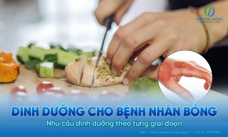 Dinh dưỡng cho bệnh nhân bỏng. Nhu cầu dinh dưỡng theo từng giai đoạn