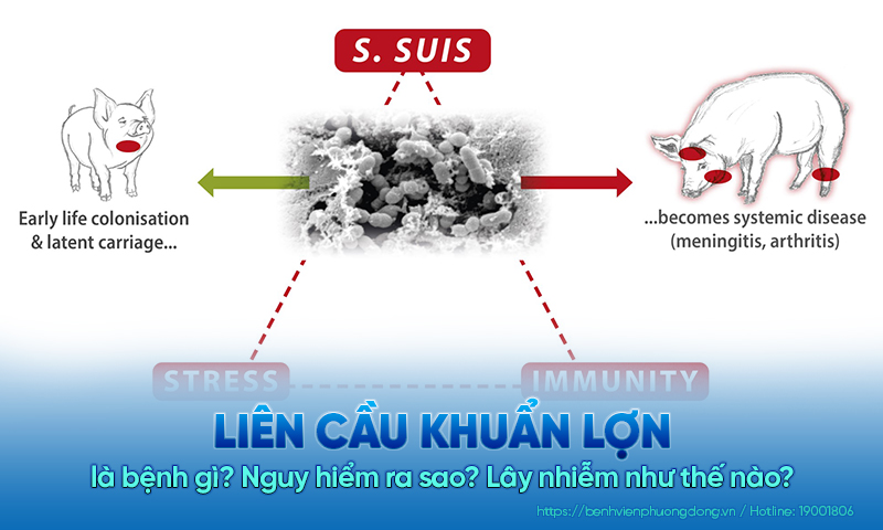 Liên cầu khuẩn lợn là bệnh gì? Nguy hiểm ra sao? Lây nhiễm như thế nào?