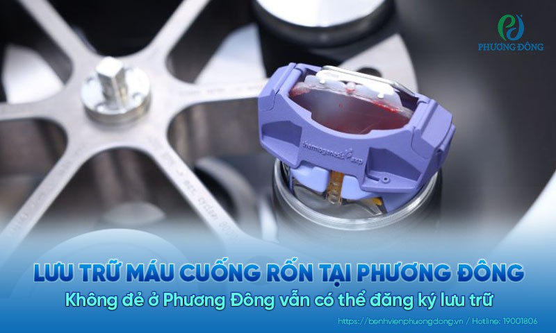 Không đẻ ở Phương Đông vẫn có thể lưu trữ máu cuống rốn tại Phương Đông