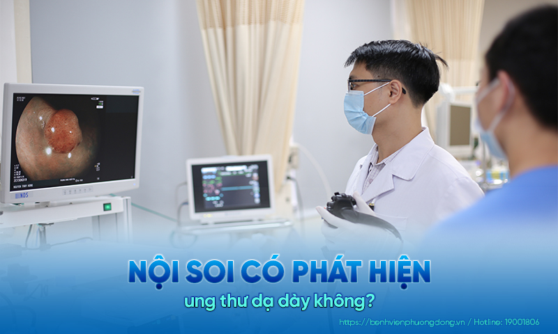 Giải đáp: Nội soi dạ dày có phát hiện ung thư không?