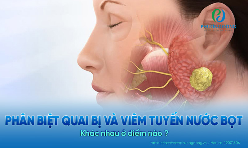 Phân biệt quai bị và viêm tuyến nước bọt: Khác nhau ở điểm nào?