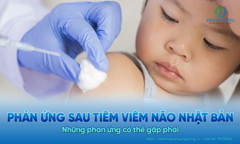 Các phản ứng sau tiêm viêm não Nhật Bản có thể xảy ra