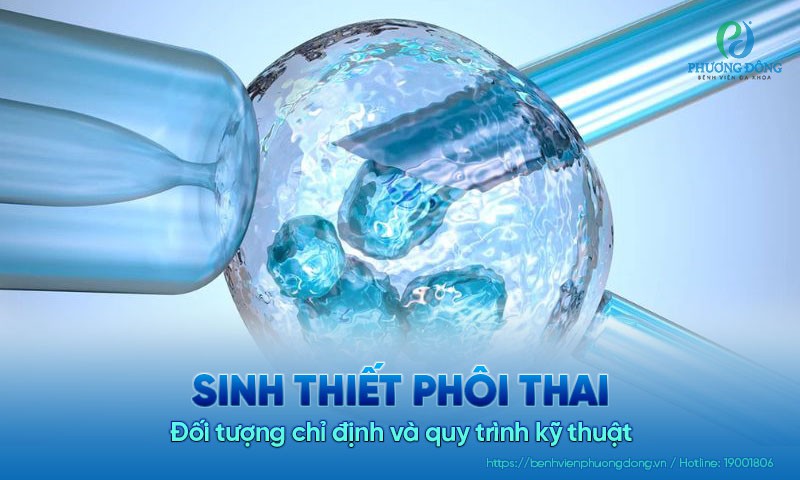 Sinh thiết phôi thai: Đối tượng chỉ định và quy trình kỹ thuật