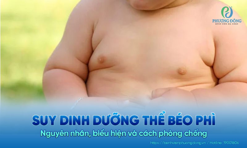 Suy dinh dưỡng thể béo phì: Nguyên nhân, biểu hiện và cách điều trị