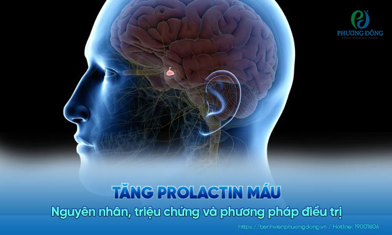 Tăng prolactin máu: Nguyên nhân, triệu chứng và phương pháp điều trị