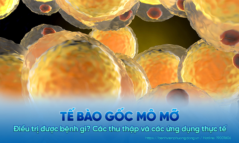 Tế bào gốc mô mỡ: Điều trị được bệnh gì? Các thu thập và các ứng dụng thực tế