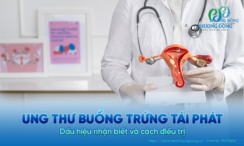 Ung thư buồng trứng tái phát: Dấu hiệu nhận biết và cách điều trị