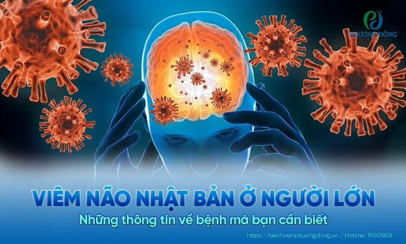 Tìm hiểu về bệnh viêm não Nhật Bản ở người lớn