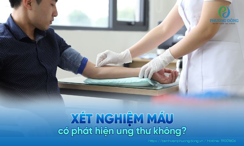 Xét nghiệm máu có phát hiện ung thư không?