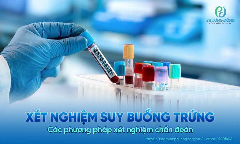 Xét nghiệm suy buồng trứng: Các phương pháp xét nghiệm chẩn đoán