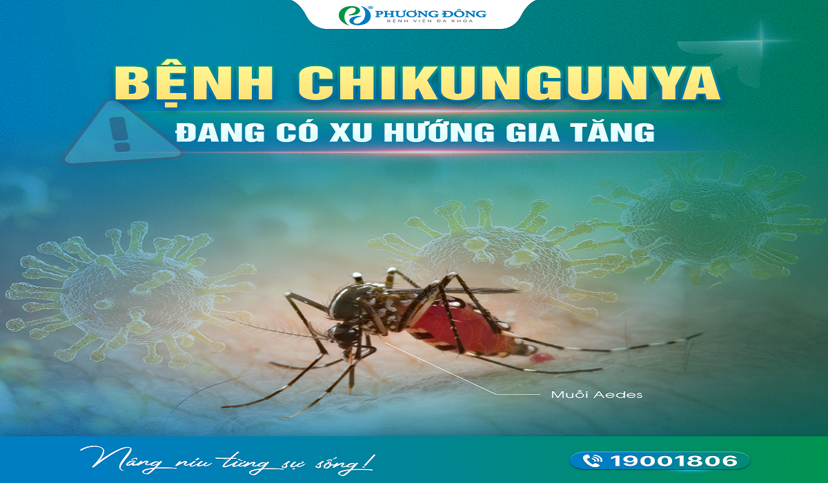 Cảnh báo: Bệnh Chikungunya đang có xu hướng gia tăng