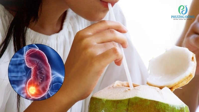 Bệnh nhân suy thận không nên uống quá 200ml nước dừa/ngày