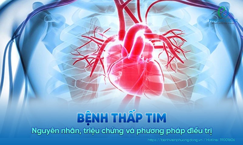 Bệnh thấp tim: Nguyên nhân, triệu chứng và phương pháp điều trị