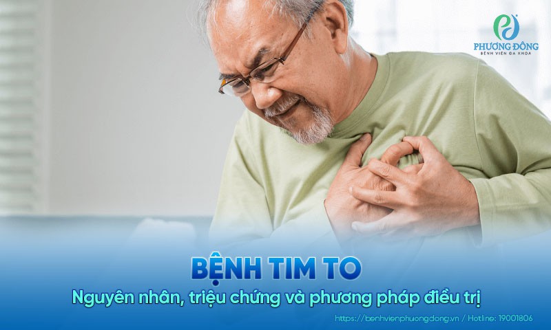 Bệnh tim to: Nguyên nhân, triệu chứng và cách điều trị