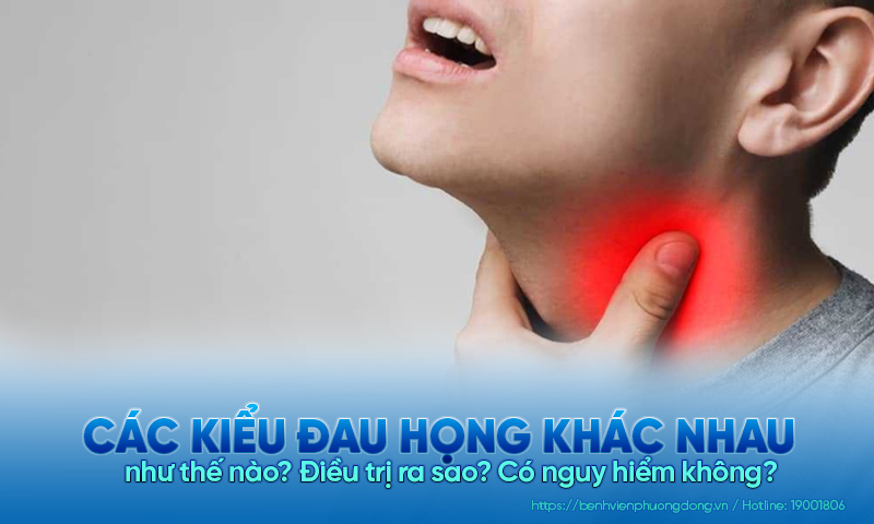 Các kiểu đau họng khác nhau như thế nào? Cách điều trị như thế nào?