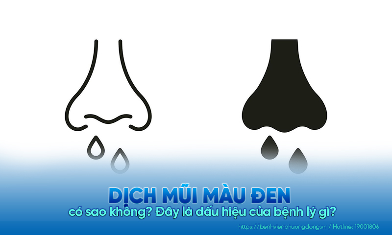 Dịch mũi màu đen có sao không? Đây là dấu hiệu của bệnh lý gì? 