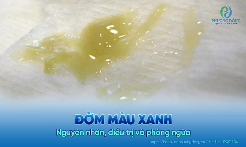 Đờm màu xanh: Nguyên nhân, điều trị và phòng ngừa