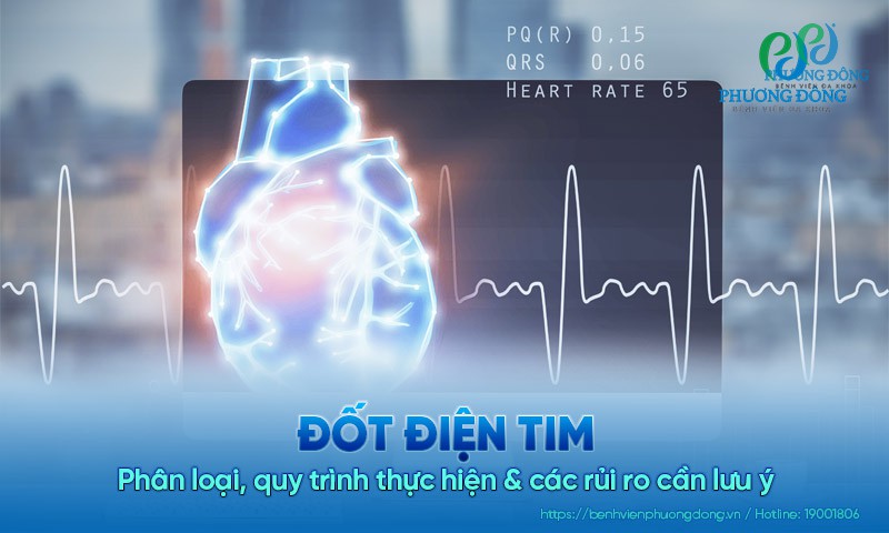 Đốt điện tim: Phân loại, quy trình thực hiện, các rủi ro cần lưu ý