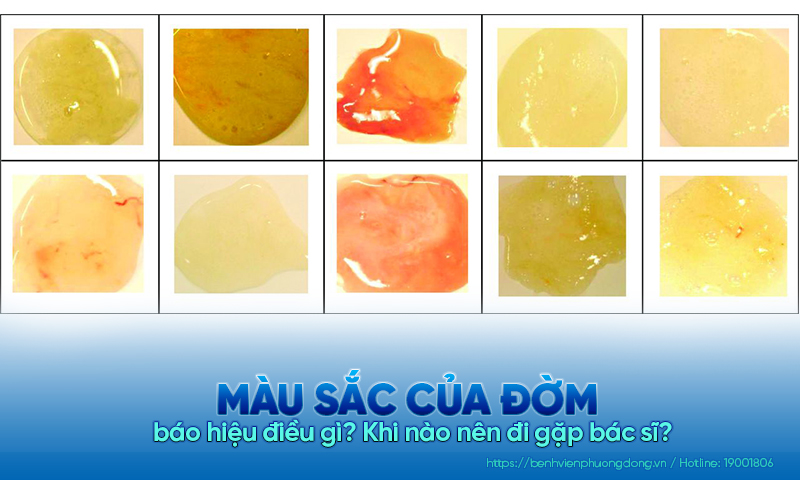 Màu sắc của đờm báo hiệu điều gì? Khi nào nên đi gặp bác sĩ?