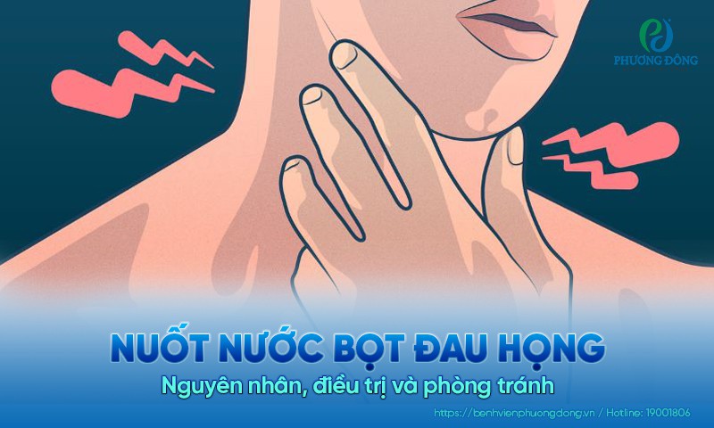 Nuốt nước bọt đau họng: Nguyên nhân, điều trị và phòng tránh