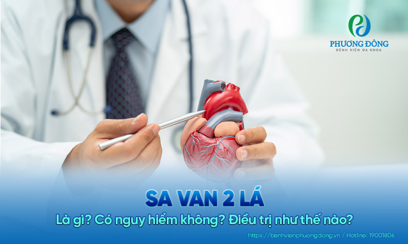 Bệnh sa van 2 lá là gì? Có nguy hiểm không? Điều trị như thế nào?