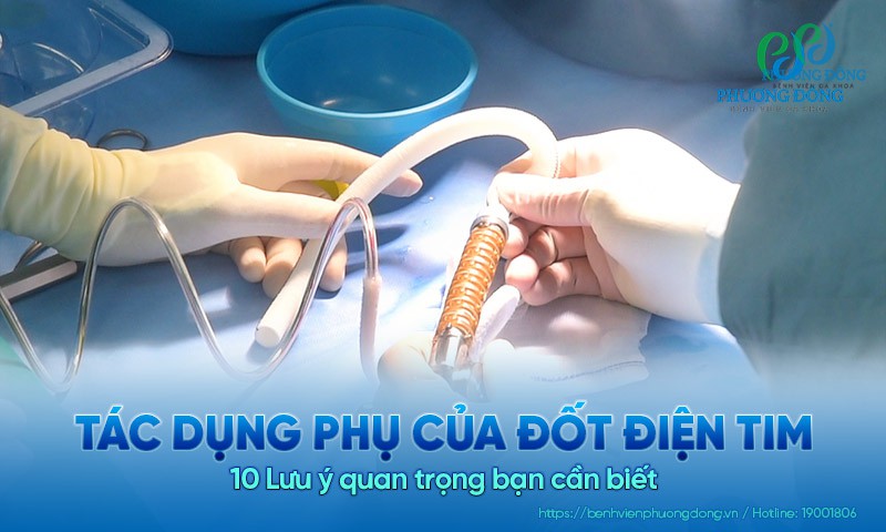 Cảnh báo: 10 Tác dụng phụ của đốt điện tim bạn cần lưu ý