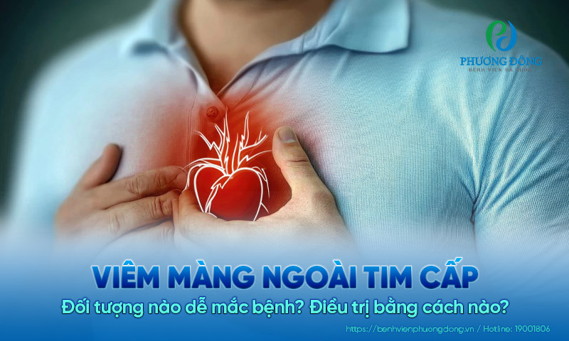 Viêm màng ngoài tim cấp: Đối tượng nào dễ mắc bệnh? Điều trị bằng cách nào?