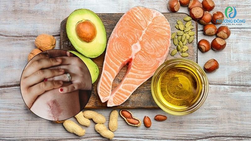 Người bị gai đôi cột sống nên ưu tiên thực phẩm giàu vitamin và khoáng chất tốt cho xương khớp