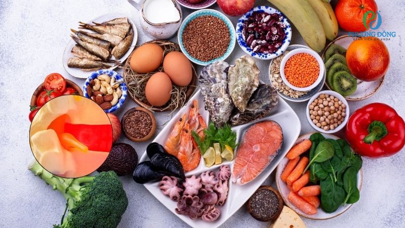 Những thực phẩm người bệnh xẹp đốt sống nên ưu tiên bổ sung