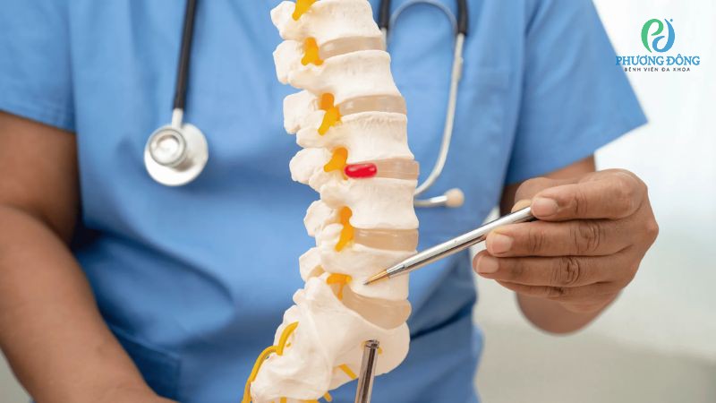Gặp gỡ bác sĩ xương khớp: Bị xẹp đốt sống lưng phải làm sao?