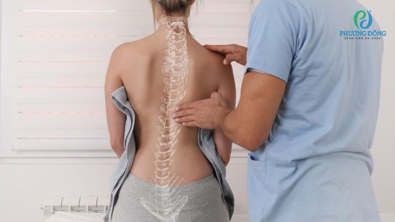 Bác sĩ trả lời: Vẹo cột sống có nguy hiểm không?