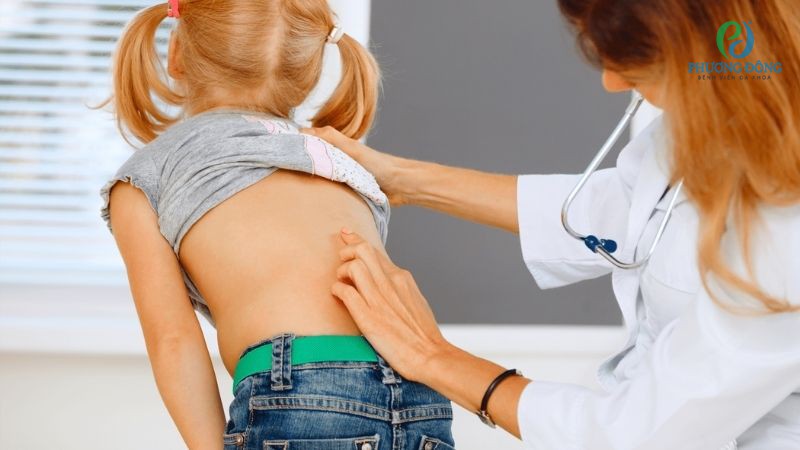 Trẻ em dễ bị cong vẹo cột sống do sai tư thế sinh hoạt thường ngày\