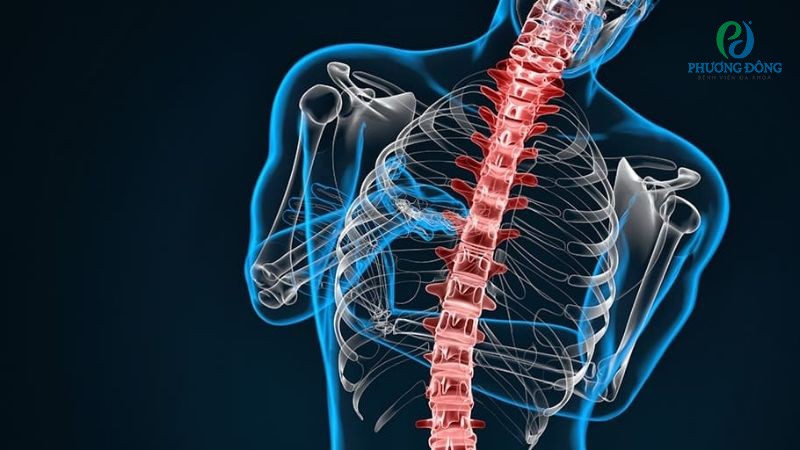 Bệnh xẹp đốt sống hoàn toàn có thể chữa trị và kiểm soát nếu tuân theo chỉ định y tế