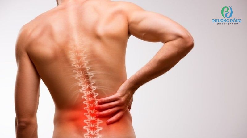 Gai đôi cột sống không được xử trí kịp thời có thể dẫn đến nhiều biến chứng nguy hiểm