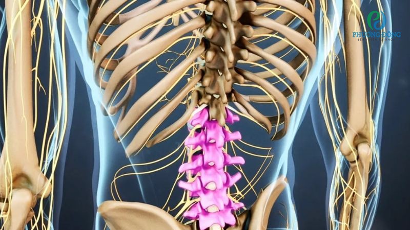 Gai cột sống lưng có thể chữa trị nhưng không dứt điểm hoàn toàn