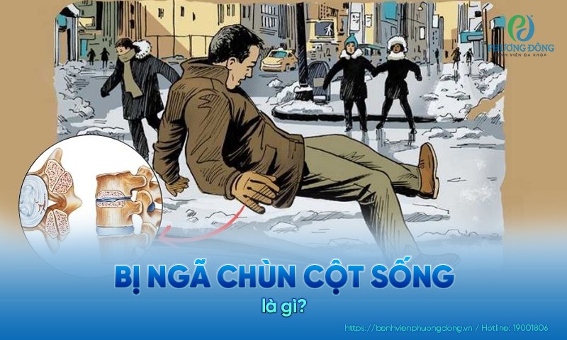 Bị ngã chùn cột sống làm xuất hiện các cơn đau nhức dữ dội