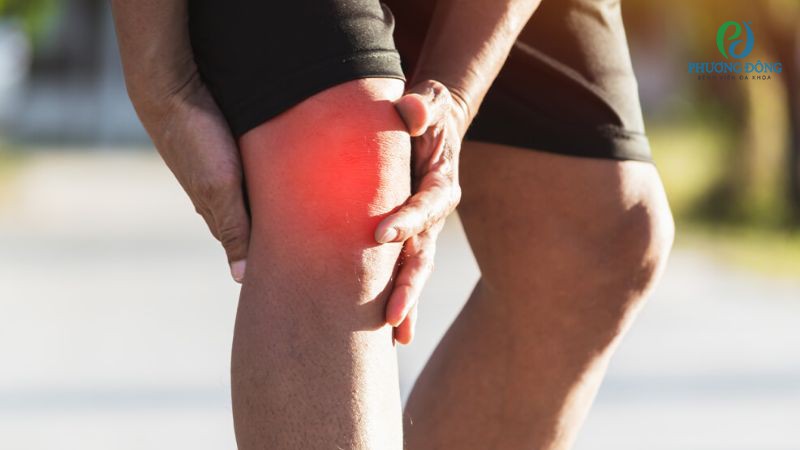 Triệu chứng lâm sàng nhận biết điểm bám dây chằng chéo trước bị bong