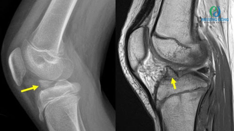 Chẩn đoán bệnh lý bằng các phương phép xét nghiệm hình ảnh học