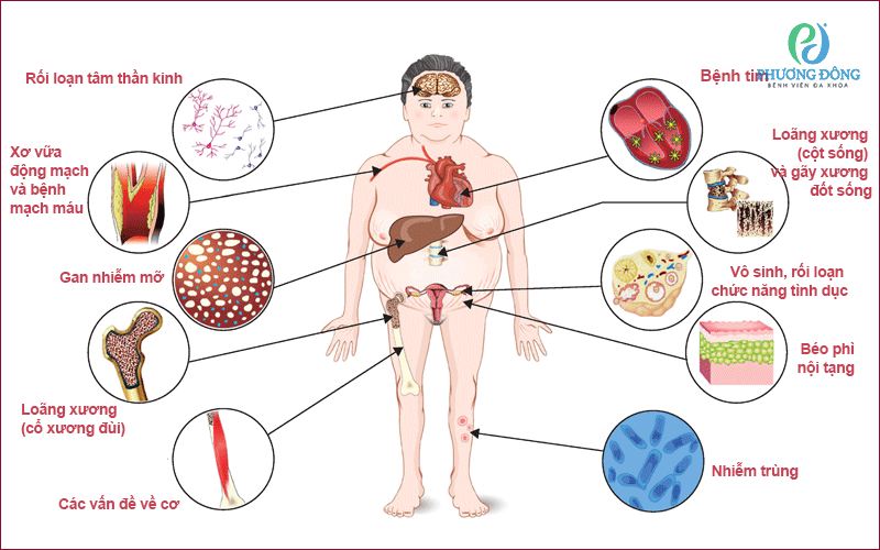 Các đặc điểm lâm sàng chồng chéo của hội chứng Cushing