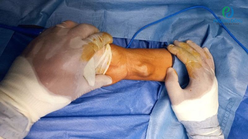 Những tổn thương có thể ảnh hưởng đến chức năng truyền dẫn tín hiệu dây thần kinh