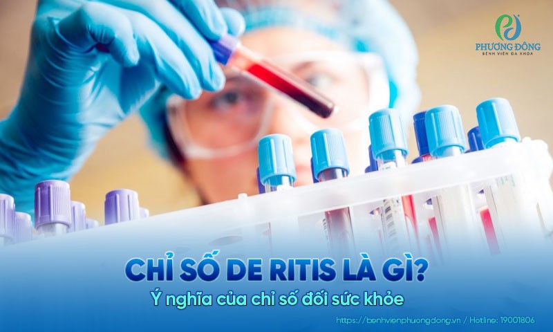 Chỉ số de ritis là gì? Ý nghĩa của chỉ số đối sức khỏe